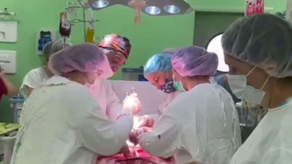 Новости Ингушетии: Врачи РКПЦ Ингушетии провели сложную операцию беременной женщине